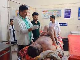 जमीन विवाद में युवक ने लगाई आग, पत्नी भी झुलसी